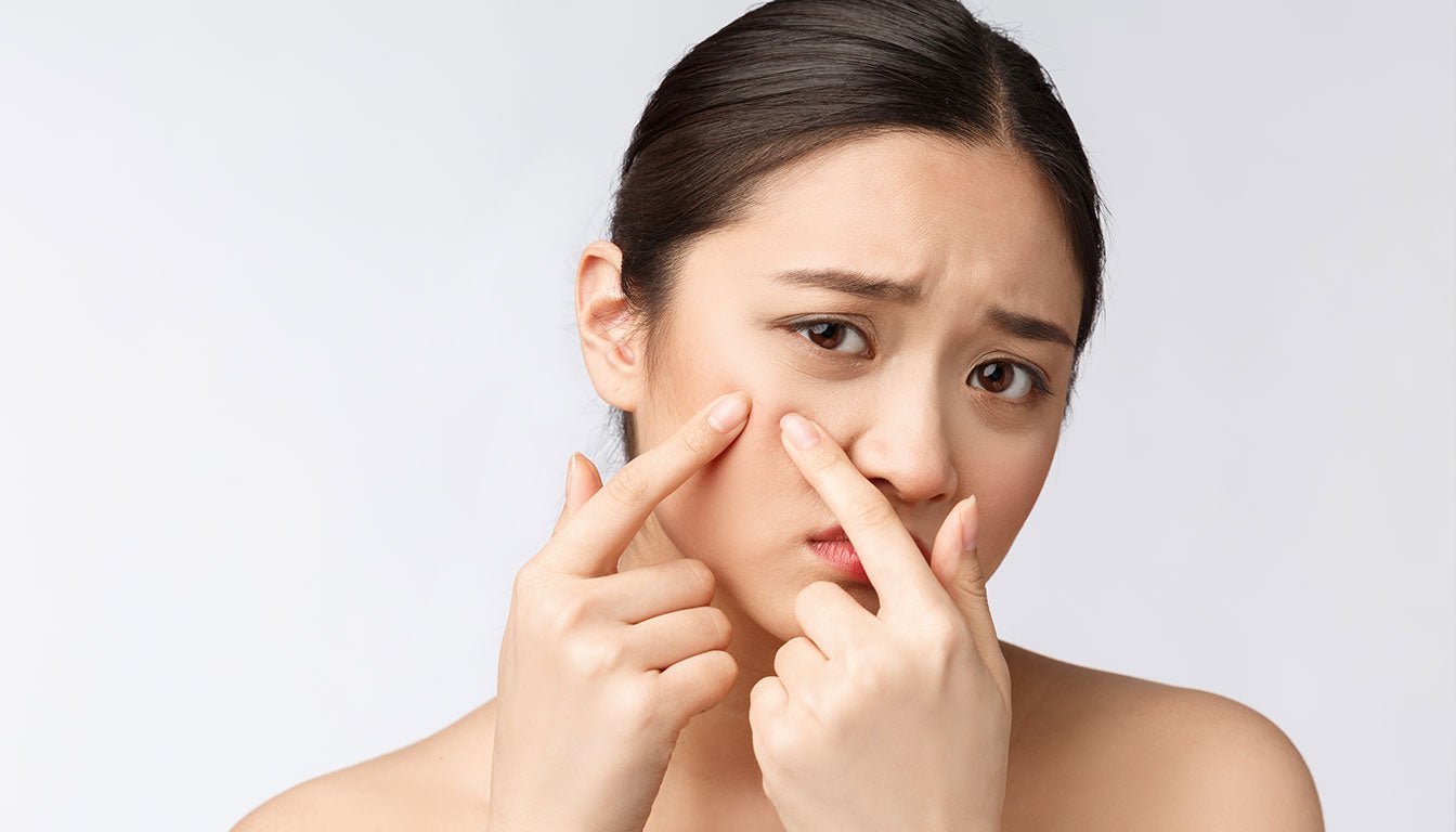 Purging Nedir? Ne Kadar Sürer? | Cilt Bakımında Geçici Tepkiler - LAPÉRAS