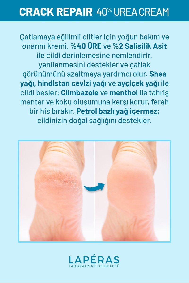 Ayak ve Topuk Çatlak Bakım Kremi %40 Üre ve %2 Salisilik Asit 75ml - LAPÉRAS